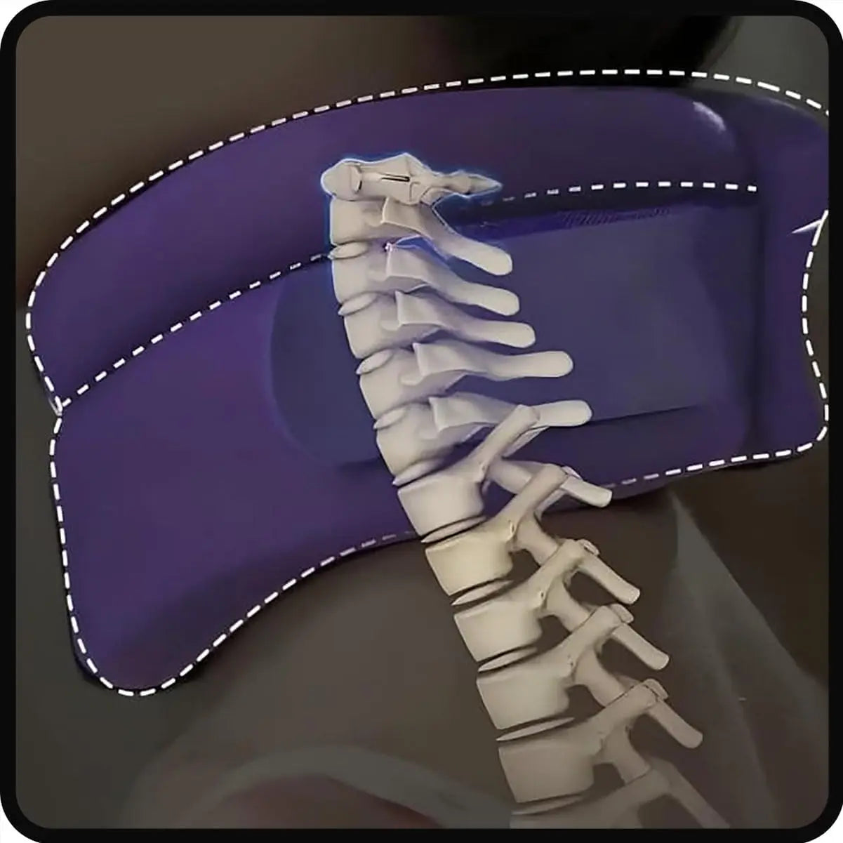 Cervicorrect Neck Brace